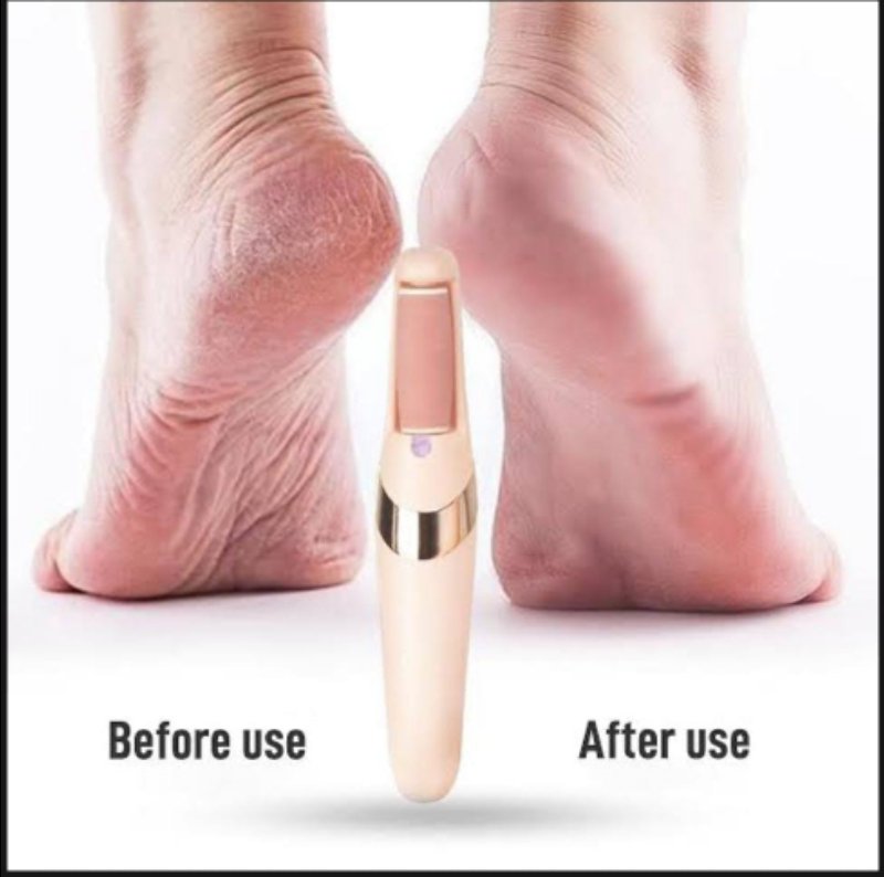 Foot file Heels grinding